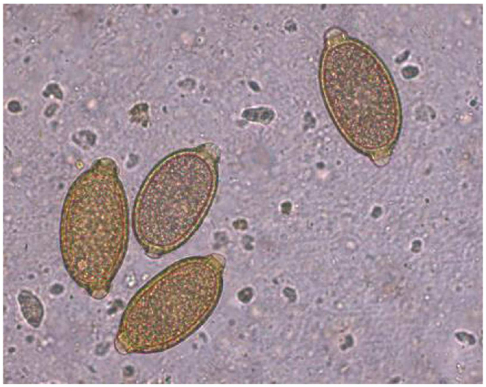 Capillaria-aerophila-eggs