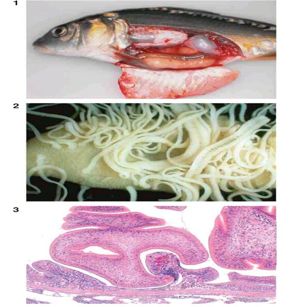 بوتریوسفالوس و چیلودونلا